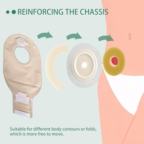 Elastic butterfly shaped stoma tape extenders protecting skin from leaks and flange warping