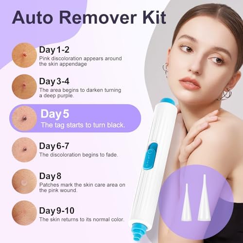 Nodhaul painless wart and skin tag removal mechanism layout with cleansing wipes.