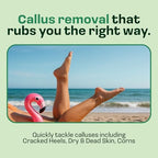 HAPPY SOLES Foot Callus Remover showcasing the three interchangeable roller heads close up.