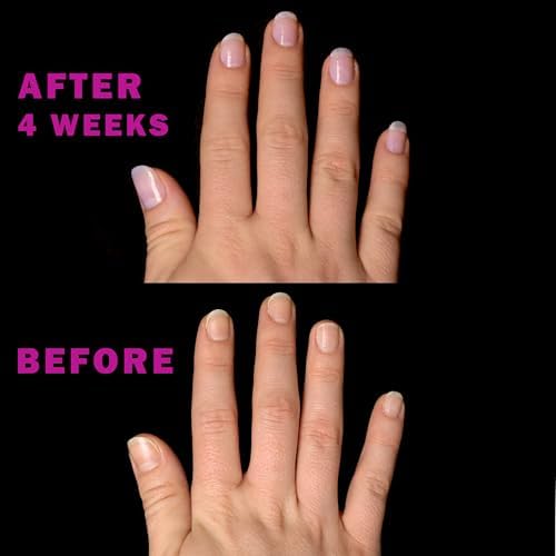 Perfect Formula nail strengthener 0.6 fluid ounce packaging