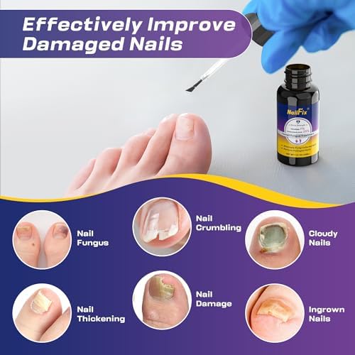 Drawzone fungal nail treatment being applied to a yellowed toenail with a brush.