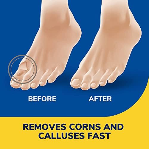 Side view of the 0.33 ounce bottle with instructions for corn and callus relief.