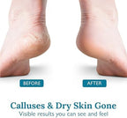 Gilden Tree 40 percent urea cream for feet maximum strength exfoliation and moisturizing.