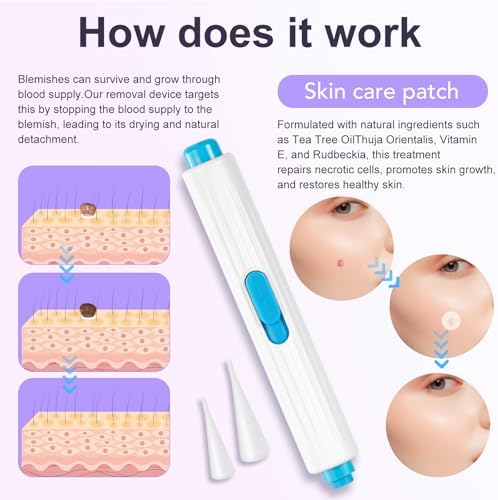 Nodhaul AL-40 beauty remover kit components for home use treatment.