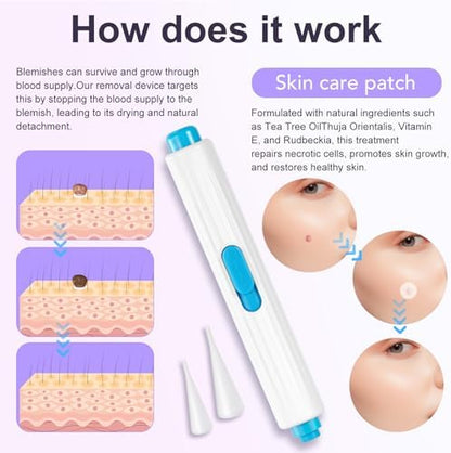 Nodhaul AL-40 beauty remover kit components for home use treatment.