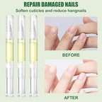 Close up of Yomacy radiant nail treatment pen