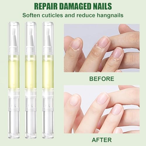 Close up of Yomacy radiant nail treatment pen