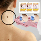 Befada fast acting wart remover serum packaging showing ingredients and directions.
