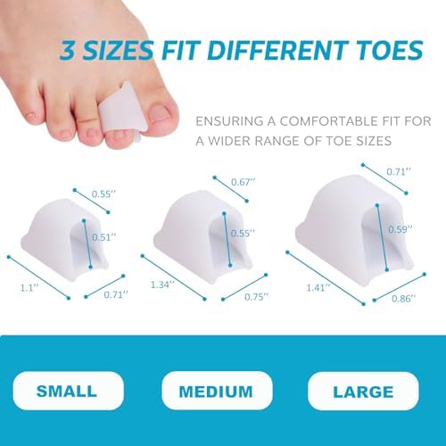 Comparison of toe alignment before and after using Nolimvita spacers.