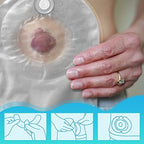 Siifert ileostomy tape strips showing the flexible medical-grade adhesive backing.