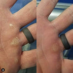 Waterproof handcare tool for repairing torn skin and flappers