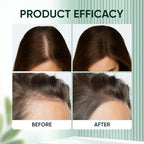 IFSLQNX PDRN Hair Ampoule side profile view