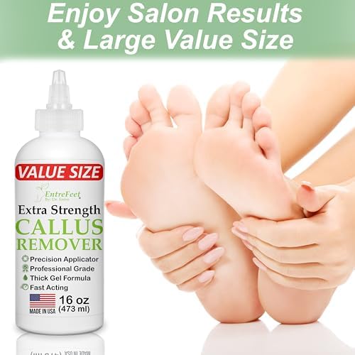 Dr. Entre's callus treatment gel for cracked heels and tough calluses