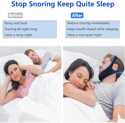 CPAP compatible chin strap for mouth breathing prevention