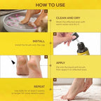 SupreH Bee Venom Wart and Corn Treatment Liquid for professional grade home care.
