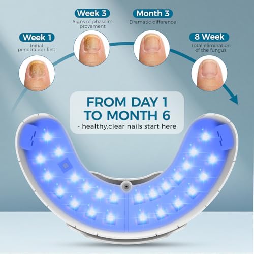 At home non invasive fungal nail treatment device with USB charging