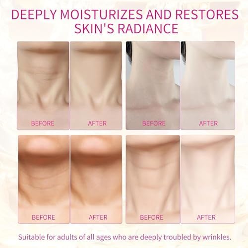 Authentic reusable silicone neck pads showing the targeted anatomical shape for horizontal neck lines.