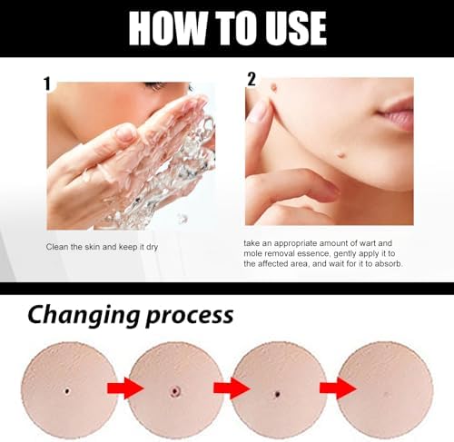 Befada skincare solution for corns and plantar warts showing bottle scale.