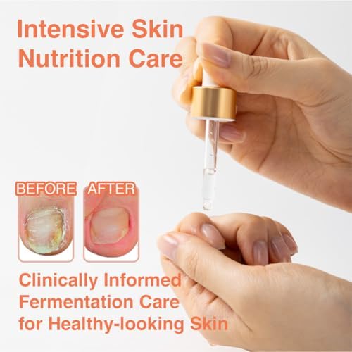 Close up of healthy nails treated with TuneTune oil