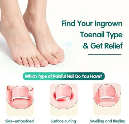 Diagram illustrating the upward tension mechanism of the paronychia treatment tool on a foot.