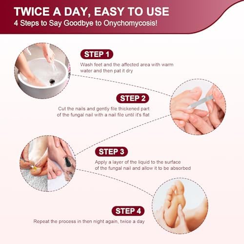 Sidinox nail repair solution with brush applicator for thick yellow toenails