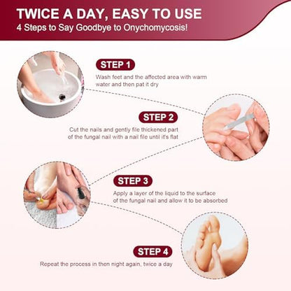Sidinox nail repair solution with brush applicator for thick yellow toenails