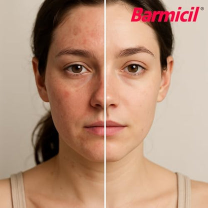 Paraben-free Barmicil hydrocortisone cream for sensitive skin and dermatitis care.