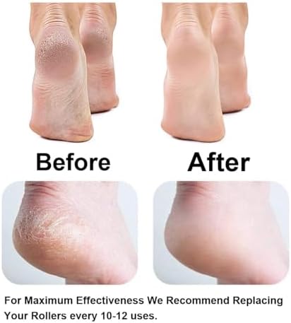 A lifestyle shot demonstrating the installation of a KOIZFF roller head into a pedicure device.