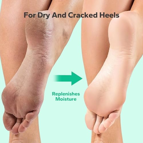 Dead skin remover gel for smooth and soft salon style feet