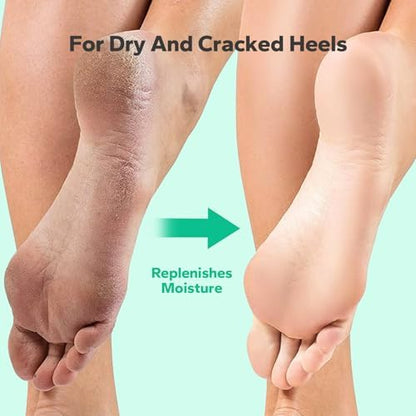 Dead skin remover gel for smooth and soft salon style feet