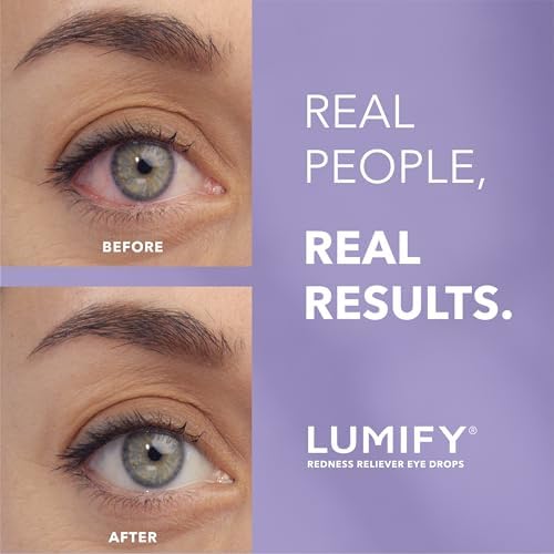 Bausch and Lomb LUMIFY eye drops packaging showing redness relief benefits