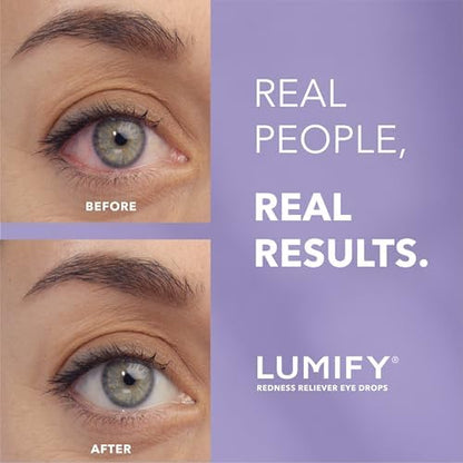 Bausch and Lomb LUMIFY eye drops packaging showing redness relief benefits