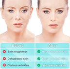LadPemo anti aging patches applied on forehead
