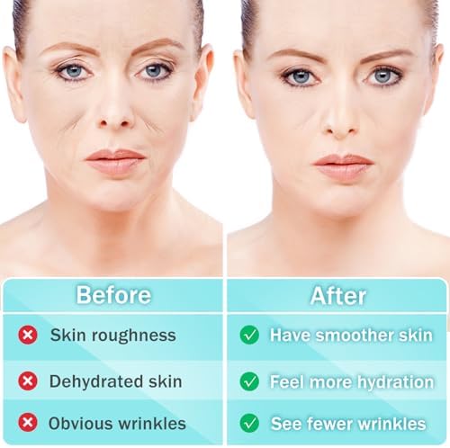 LadPemo facial smoothing patches pre cut shapes designed for smile lines and laugh lines.