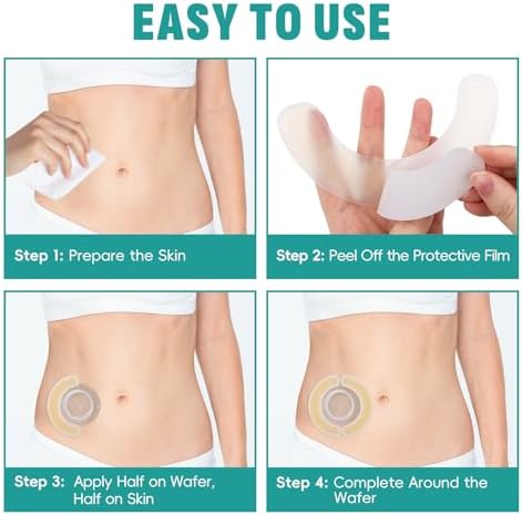 Close-up of the flexible skin-friendly medical grade material of the ostomy supplies extender.