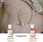 Applying Detachol adhesive remover to gently lift medical tape from the skin surface.