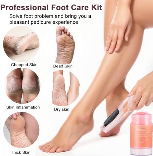 Before and after demonstration of dead skin removal using a pink pedicure device.