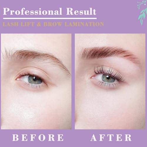 Silicone lifting pads in multiple sizes included in the Dahpure eyelash curling set.