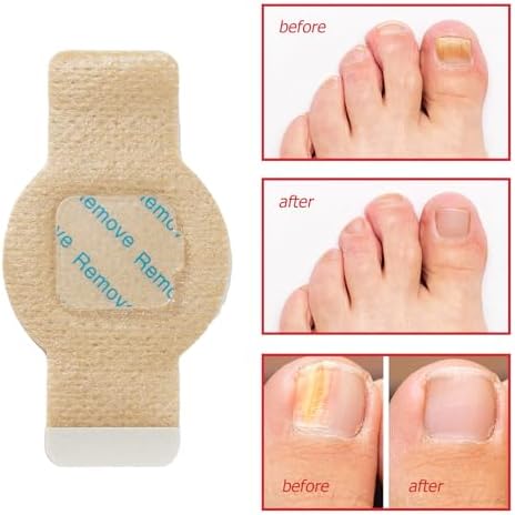 HUBTURE twenty one piece nail care kit showing individual patches and professional nail file