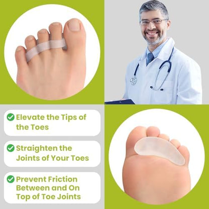 Bukihome professional foot care kit with multiple loop sizes for customized toe correction