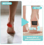 Waterproof adhesive moleskin roll being cut to size for foot care.