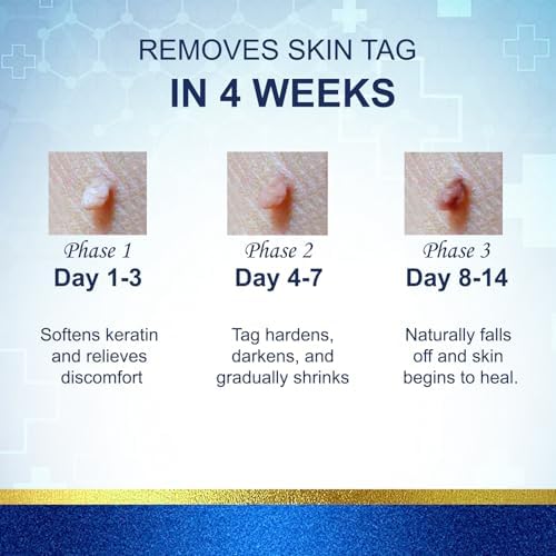 TWICETWO Fast-Acting Skin Tag Remover packaging highlighting the 30ml size and easy action formula.