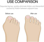 Soft medical grade silicone toe straightener for foot pain relief.