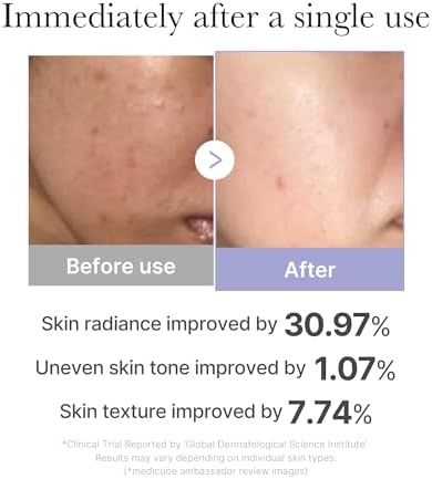 Korean facial device for beginners boosting radiance and glow