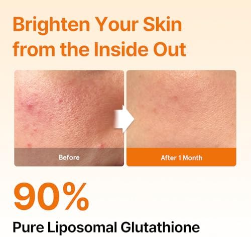 Esther Formula liposomal glutathione strips container open view