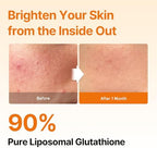 Esther Formula liposomal glutathione strips container open view