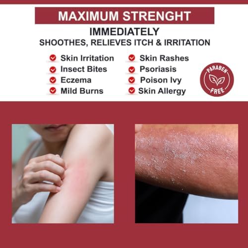 Quatriderm NF paraben-free anti-itch cream tube with aloe vera