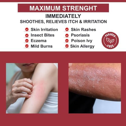 Quatriderm NF paraben-free anti-itch cream tube with aloe vera