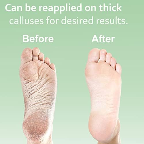 USA manufactured callus remover gel for professional pedicure results at home.