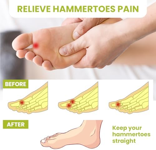 Bukihome toe straighteners worn on foot showing proper alignment positioning